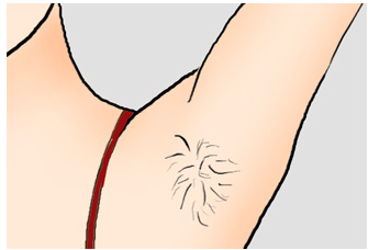 從毛茸茸到光滑如絲，最新脫毛價(jià)格指南，自信之旅啟程！